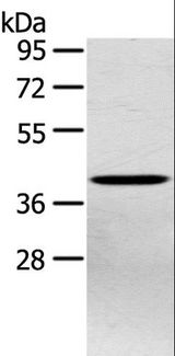 PTX3 / Pentraxin 3 Antibody - Western blot analysis of Hepg2 cell, using PTX3 Polyclonal Antibody at dilution of 1:400.