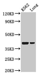 PTX3 / Pentraxin 3 Antibody - Positive Western Blot detected in K562 whole cell lysate, Rat lung tissue. All lanes: PTX3 antibody at 2 µg/ml Secondary Goat polyclonal to rabbit IgG at 1/50000 dilution. Predicted band size: 42 KDa. Observed band size: 42 KDa