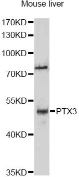 PTX3 / Pentraxin 3 Antibody - Western blot analysis of extracts of mouse liver, using PTX3 antibody at 1:3000 dilution. The secondary antibody used was an HRP Goat Anti-Rabbit IgG (H+L) at 1:10000 dilution. Lysates were loaded 25ug per lane and 3% nonfat dry milk in TBST was used for blocking. An ECL Kit was used for detection and the exposure time was 90s.