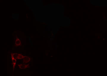 PTX3 / Pentraxin 3 Antibody - Staining 293 cells by IF/ICC. The samples were fixed with PFA and permeabilized in 0.1% Triton X-100, then blocked in 10% serum for 45 min at 25°C. The primary antibody was diluted at 1:200 and incubated with the sample for 1 hour at 37°C. An Alexa Fluor 594 conjugated goat anti-rabbit IgG (H+L) antibody, diluted at 1/600, was used as secondary antibody.