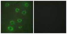 PTX3 / Pentraxin 3 Antibody - Peptide - + Immunofluorescence analysis of HUVEC cells, using PTX3 antibody.