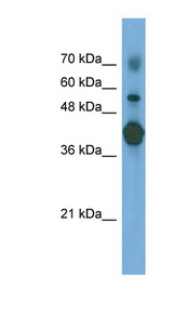PTX3 / Pentraxin 3 Antibody - PTX3 antibody Western blot of Transfected 293T cell lysate. This image was taken for the unconjugated form of this product. Other forms have not been tested.