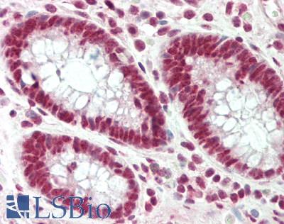 PUF60 Antibody - Human Colon: Formalin-Fixed, Paraffin-Embedded (FFPE).  This image was taken for the unconjugated form of this product. Other forms have not been tested.