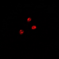 PUF60 Antibody - Immunofluorescent analysis of FIR staining in HeLa cells. Formalin-fixed cells were permeabilized with 0.1% Triton X-100 in TBS for 5-10 minutes and blocked with 3% BSA-PBS for 30 minutes at room temperature. Cells were probed with the primary antibody in 3% BSA-PBS and incubated overnight at 4 deg C in a humidified chamber. Cells were washed with PBST and incubated with a DyLight 594-conjugated secondary antibody (red) in PBS at room temperature in the dark.
