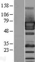 PUF60 Protein - Western validation with an anti-DDK antibody * L: Control HEK293 lysate R: Over-expression lysate