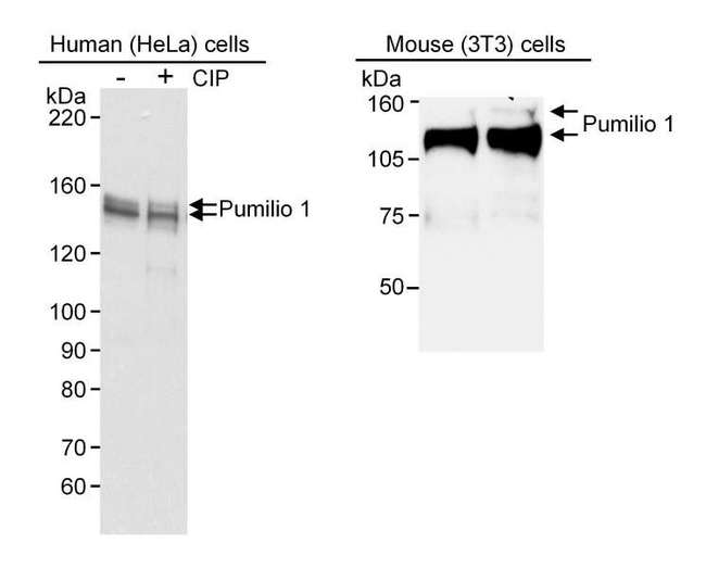 PUM1 Antibody - Detection of Human and Mouse Pumilio 1 by Western Blot. Samples: RIPA extract from HeLa (10 ug) and 3T3 (50 ug) cells. Antibody: Affinity purified goat anti-Pumilio 1 used at 0.03 ug/ml for HeLa extract and 0.1 ug/ml for 3T3 extract. Detection: Chemiluminescence with 1 minute exposure. (CIP: Calf Intestinal Phosphatase).