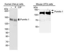 PUM1 Antibody - Detection of Human and Mouse Pumilio 1 by Western Blot. Samples: RIPA extract from HeLa (10 ug) and 3T3 (50 ug) cells. Antibody: Affinity purified goat anti-Pumilio 1 used at 0.03 ug/ml for HeLa extract and 0.1 ug/ml for 3T3 extract. Detection: Chemiluminescence with 1 minute exposure. (CIP: Calf Intestinal Phosphatase).