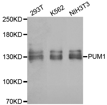 PUM1 Antibody - Western blot analysis of extracts of various cell lines.