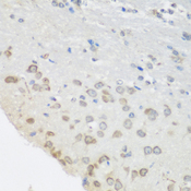 PUM1 Antibody - Immunohistochemistry of paraffin-embedded mouse brain tissue.