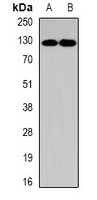 PUM1 Antibody - Western blot analysis of Pumilio 1 expression in K562 (A); NIH3T3 (B) whole cell lysates.
