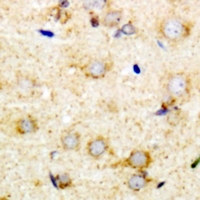 PUM1 Antibody - Immunohistochemical analysis of Pumilio 1 staining in mouse brain formalin fixed paraffin embedded tissue section. The section was pre-treated using heat mediated antigen retrieval with sodium citrate buffer (pH 6.0). The section was then incubated with the antibody at room temperature and detected using an HRP conjugated compact polymer system. DAB was used as the chromogen. The section was then counterstained with hematoxylin and mounted with DPX.