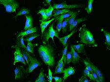 PUM1 Antibody - Immunofluorescence staining of PUM1 in U251MG cells. Cells were fixed with 4% PFA, permeabilzed with 0.1% Triton X-100 in PBS, blocked with 10% serum, and incubated with rabbit anti-Human PUM1 polyclonal antibody (dilution ratio 1:200) at 4°C overnight. Then cells were stained with the Alexa Fluor 488-conjugated Goat Anti-rabbit IgG secondary antibody (green) and counterstained with DAPI (blue). Positive staining was localized to Cytoplasm.
