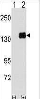 PUM1 Antibody - Western blot of PUM1 (arrow) using PUM1 Antibody (Y83). 293 cell lysates (2 ug/lane) either nontransfected (Lane 1) or transiently transfected with the PUM1 gene (Lane 2) (Origene Technologies).