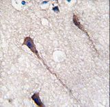 PUM1 Antibody - Formalin-fixed and paraffin-embedded human brain tissue reacted with Phospho-PUM1-Y83.control antibody, which was peroxidase-conjugated to the secondary antibody, followed by DAB staining. This data demonstrates the use of this antibody for immunohistochemistry; clinical relevance has not been evaluated.