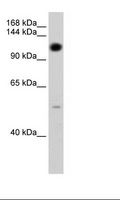 PUM2 Antibody - Transfected 293T Cell Lysate.  This image was taken for the unconjugated form of this product. Other forms have not been tested.