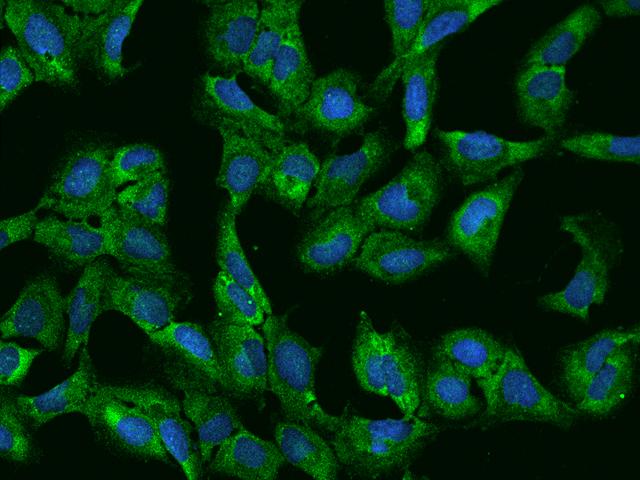 PUM2 Antibody - Immunofluorescence staining of PUM2 in U2OS cells. Cells were fixed with 4% PFA, permeabilzed with 0.1% Triton X-100 in PBS, blocked with 10% serum, and incubated with rabbit anti-Human PUM2 polyclonal antibody (dilution ratio 1:200) at 4°C overnight. Then cells were stained with the Alexa Fluor 488-conjugated Goat Anti-rabbit IgG secondary antibody (green) and counterstained with DAPI (blue). Positive staining was localized to Cytoplasm.