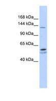 PUM2 Antibody - PUM2 antibody Western blot of Fetal Liver lysate. This image was taken for the unconjugated form of this product. Other forms have not been tested.