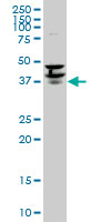 PURA / Pur-Alpha Antibody - PURA monoclonal antibody (M02), clone 1C10. Western blot of PURA expression in PC-12.