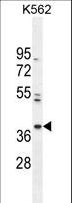 PURG Antibody - PURG Antibody western blot of K562 cell line lysates (35 ug/lane). The PURG antibody detected the PURG protein (arrow).