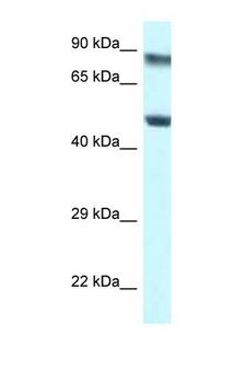 PUS1 Antibody - PUS1 antibody Western blot of Jurkat Cell lysate. Antibody concentration 1 ug/ml.  This image was taken for the unconjugated form of this product. Other forms have not been tested.