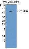 PUS1 Antibody - Western Blot; Sample: Recombinant protein.