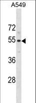 PUS10 Antibody - PUS10 Antibody western blot of A549 cell line lysates (35 ug/lane). The PUS10 antibody detected the PUS10 protein (arrow).
