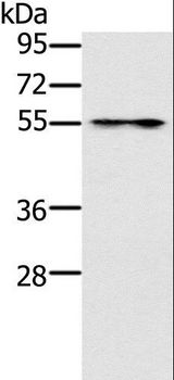 PUS10 Antibody - Western blot analysis of Mouse intestinum tenue tissue, using PUS10 Polyclonal Antibody at dilution of 1:200.
