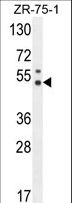 PUS3 Antibody - PUS3 Antibody western blot of ZR-75-1 cell line lysates (35 ug/lane). The PUS3 antibody detected the PUS3 protein (arrow).