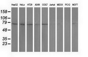 PUS7 Antibody - Western blot of extracts (35 ug) from 9 different cell lines by using anti-PUS7 monoclonal antibody.