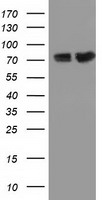 PUS7 Antibody - HEK293T cells were transfected with the pCMV6-ENTRY control (Left lane) or pCMV6-ENTRY PUS7 (Right lane) cDNA for 48 hrs and lysed. Equivalent amounts of cell lysates (5 ug per lane) were separated by SDS-PAGE and immunoblotted with anti-PUS7.
