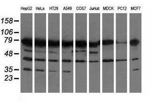 PUS7 Antibody - Western blot analysis of extracts (35ug) from 9 different cell lines by using anti-PUS7 monoclonal antibody.