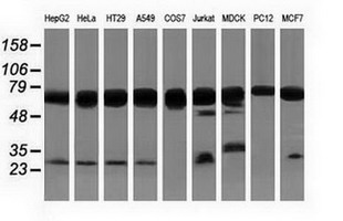 PUS7 Antibody - Western blot of extracts (35 ug) from 9 different cell lines by using anti-PUS7 monoclonal antibody.