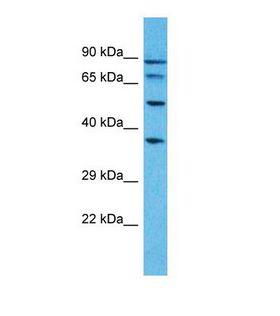PUS7L Antibody - Western blot of Human HepG2. PUS7L antibody dilution 1.0 ug/ml.  This image was taken for the unconjugated form of this product. Other forms have not been tested.