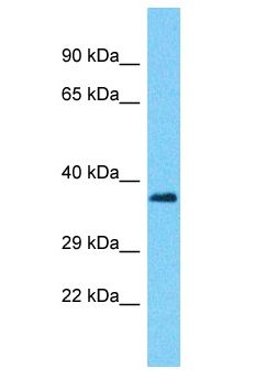 PUS7L Antibody - PUS7L antibody Western Blot of THP-1. Antibody dilution: 1 ug/ml.  This image was taken for the unconjugated form of this product. Other forms have not been tested.