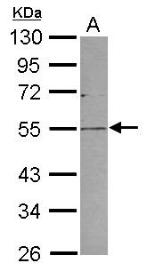PV1 / PLVAP Antibody - Sample (30 ug of whole cell lysate) A: 293T 10% SDS PAGE PLVAP antibody diluted at 1:1000