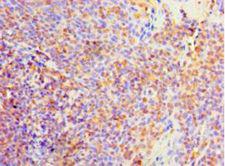 PVALB / Parvalbumin Antibody - Immunohistochemistry of paraffin-embedded human tonsil tissue using antibody at 1:100 dilution.  This image was taken for the unconjugated form of this product. Other forms have not been tested.
