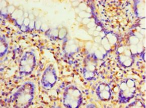 PVALB / Parvalbumin Antibody - Immunohistochemistry of paraffin-embedded human small intestine tissue using antibody at 1: 100 dilution.  This image was taken for the unconjugated form of this product. Other forms have not been tested.