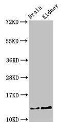 PVALB / Parvalbumin Antibody - Western Blot Positive WB detected in: mouse brain tissue, Mouse kidney tissue All lanes: PVALB antibody at 3µg/ml Secondary Goat polyclonal to rabbit IgG at 1/50000 dilution Predicted band size: 13 kDa Observed band size: 13 kDa