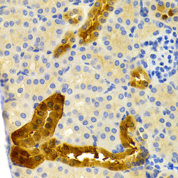 PVALB / Parvalbumin Antibody - Immunohistochemistry of paraffin-embedded mouse kidney tissue.