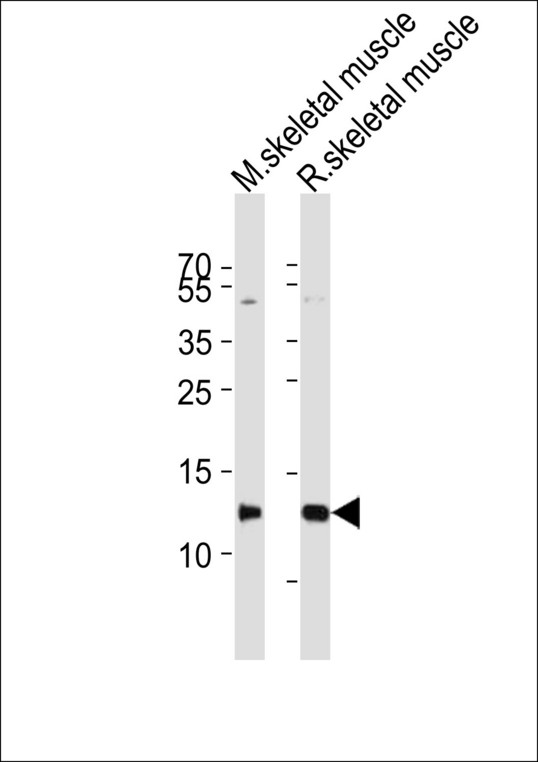 PVALB / Parvalbumin Antibody - Western blot of lysates from mouse skeletal muscle,rat skeletal muscle tissue lysate (from left to right), using PVALB Antibody(A1-1909). A1-1909 was diluted at 1:1000 at each lane. A goat anti-rabbit IgG H&L (HRP) at 1:10000 dilution was used as the secondary antibody.Lysates at 20 ug per lane.
