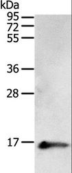 PVALB / Parvalbumin Antibody - Western blot analysis of Human fetal brain tissue, using PVALB Polyclonal Antibody at dilution of 1:400.