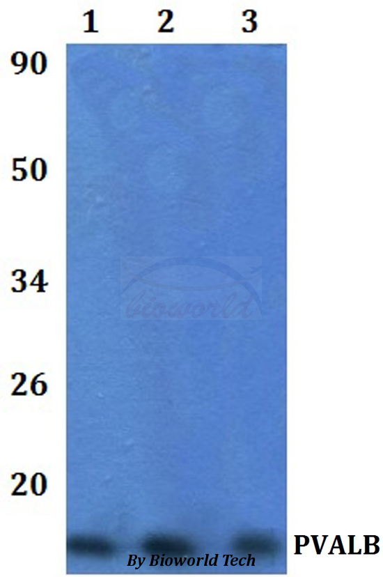 PVALB / Parvalbumin Antibody - Western blot of PVALB antibody at 1:500 dilution. Lane 1: HEK293T whole cell lysate. Lane 2: The Muscle tissue lysate of Mouse.