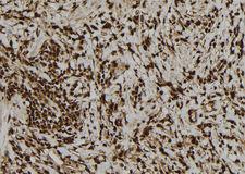 PVALB / Parvalbumin Antibody - 1:100 staining human gastric tissue by IHC-P. The sample was formaldehyde fixed and a heat mediated antigen retrieval step in citrate buffer was performed. The sample was then blocked and incubated with the antibody for 1.5 hours at 22°C. An HRP conjugated goat anti-rabbit antibody was used as the secondary.