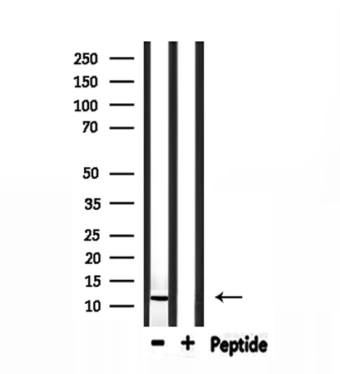 PVALB / Parvalbumin Antibody - Western blot analysis of extracts of rat muscle using Parvalbumin antibody.