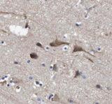 PVALB / Parvalbumin Antibody - Immunohistochemistry of paraffin-embedded human brain tissue slide using Parvalbumin antibody at dilution of 1:200