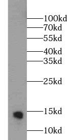 PVALB / Parvalbumin Antibody - Mouse brain tissue were subjected to SDS PAGE followed by western blot with Parvalbumin antibody at dilution of 1:1000