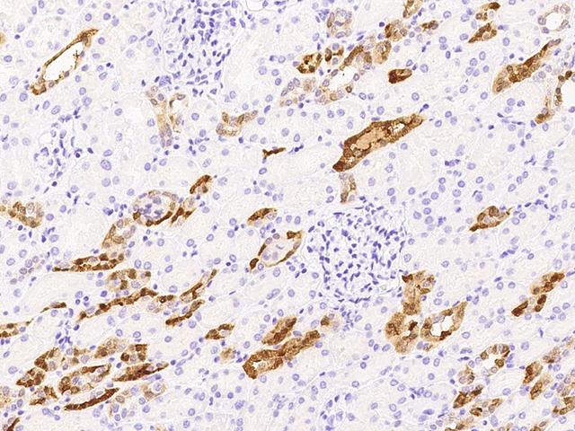 PVALB / Parvalbumin Antibody - Immunochemical staining of human PVALB in human kidney with rabbit polyclonal antibody at 1:10000 dilution, formalin-fixed paraffin embedded sections.