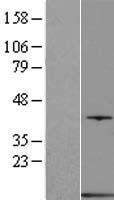 PVALB / Parvalbumin Protein - Western validation with an anti-DDK antibody * L: Control HEK293 lysate R: Over-expression lysate