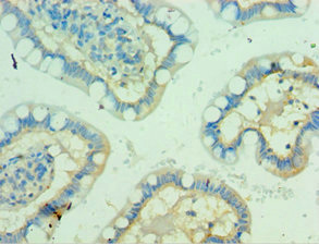 PVR / CD155 Antibody - Immunohistochemistry of paraffin-embedded human small intestine tissue using PVR Antibody at dilution of 1:100
