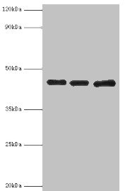 PVR / CD155 Antibody - Western blot All lanes: Poliovirus receptor antibody at 3µg/ml Lane 1: Mouse gonad tissue Lane 2: HepG2 whole cell lysate Lane 3: K562 whole cell lysate Secondary Goat polyclonal to rabbit IgG at 1/10000 dilution Predicted band size: 46, 41, 40, 43 kDa Observed band size: 46 kDa